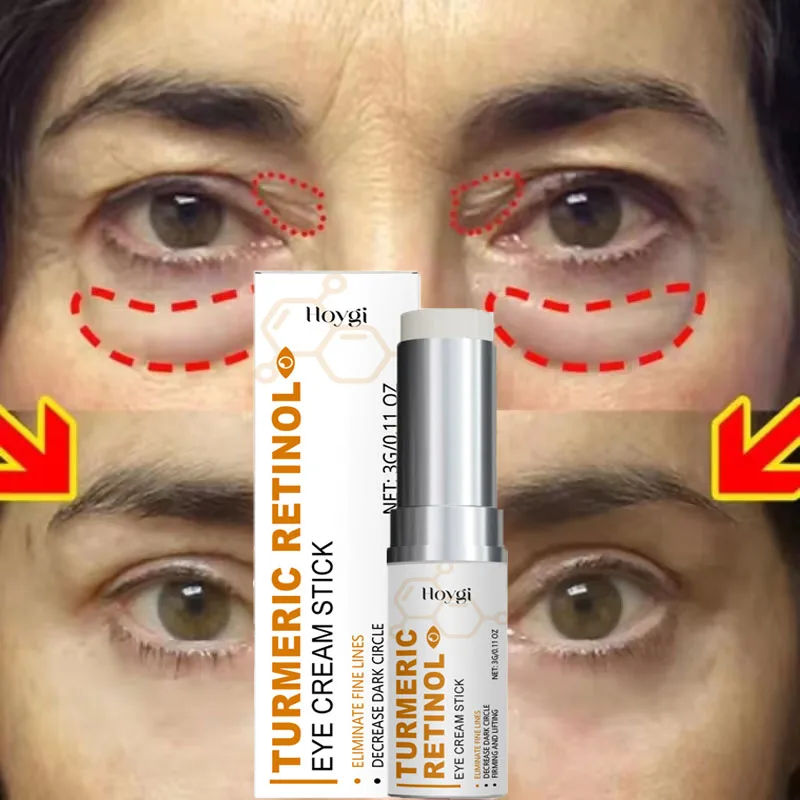 

Retinol Instant Eye Bag Removal Cream Stick Anti-Wrinkle Fade Fine Lines Firming Anti Dark Circle Puffiness Brighten Eye Care