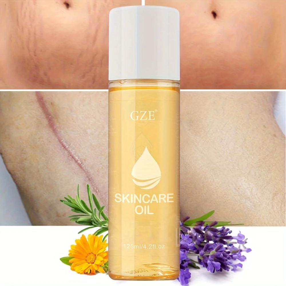 Advanced Stretch Mark Oil for Fading and Preventing Stretch Marks - with Hydrating and Nourishing Ingredients - Weight Loss