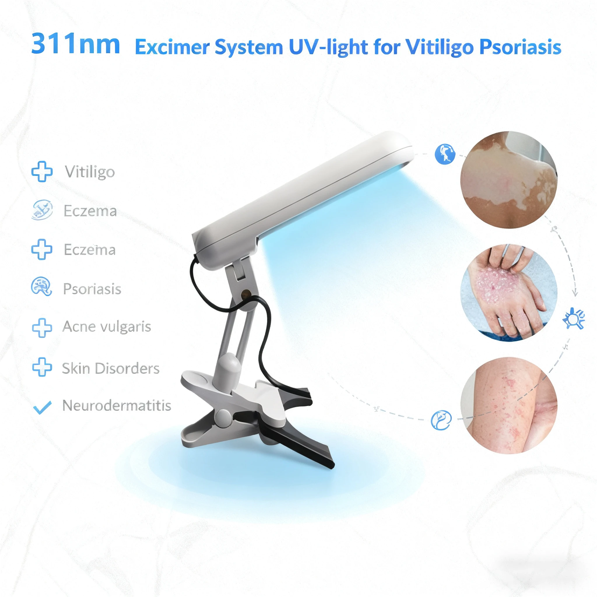 Instrumento de terapia de banda estrecha UVB de 311nm, lámpara de fototerapia UV para lámpara de terapia de Vitiligo, tratamiento de enfermedades de la piel de la Psoriasis en el hogar