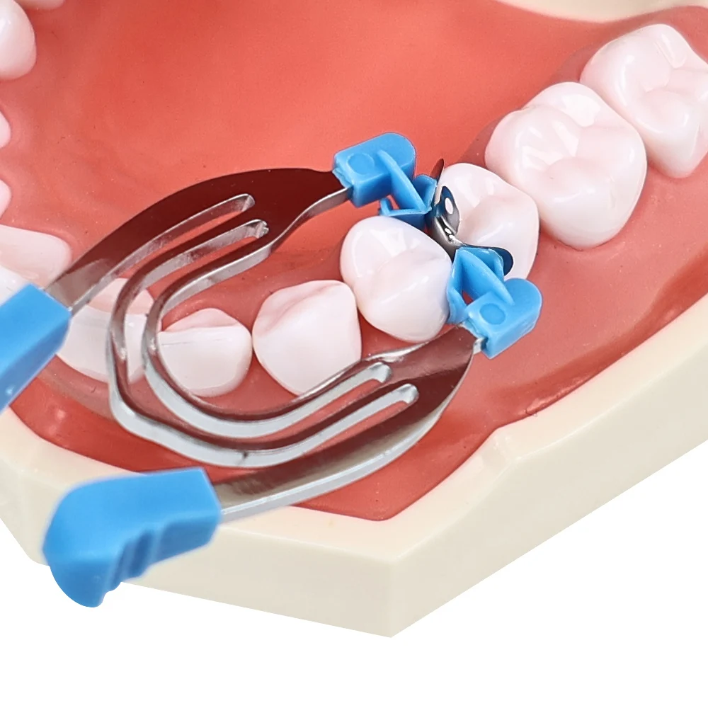 Dental Matrix Bands Sectional Contoured Matrix System Dental Metal Matrices For Teeth Replacement Dentistry Material Tools