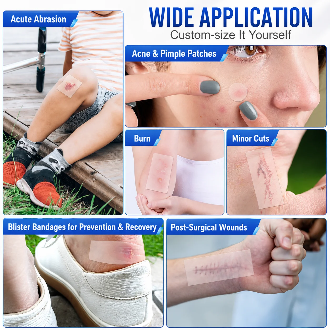 Pimple Patch Artificial Skin Wound Dressing Freely Cuttable Skin-Friendly Adhesive Keep Wound Clean 1 Roll Value Pack.