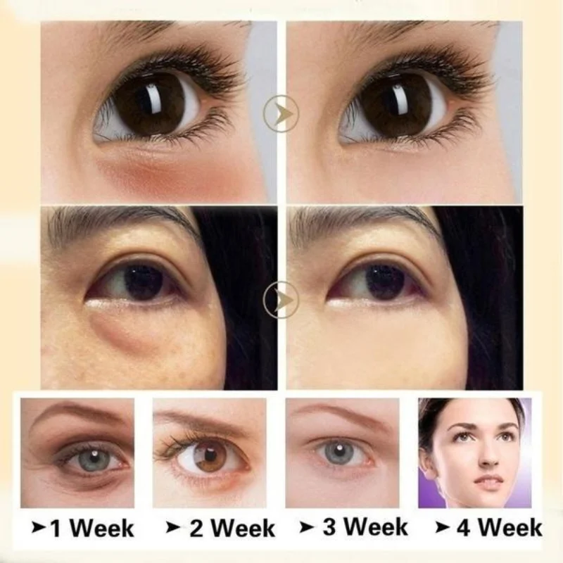 Crema reafirmante de Ojos de genciana, para eliminar ojeras, bolsas de ojos, gránulos de grasa, reafirmante, reduce la apariencia de las arrugas