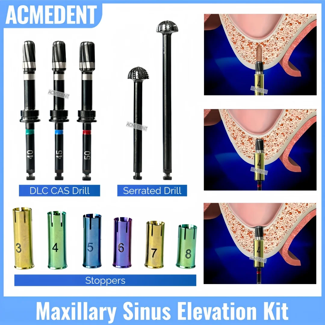 Dental Maxillary Si…