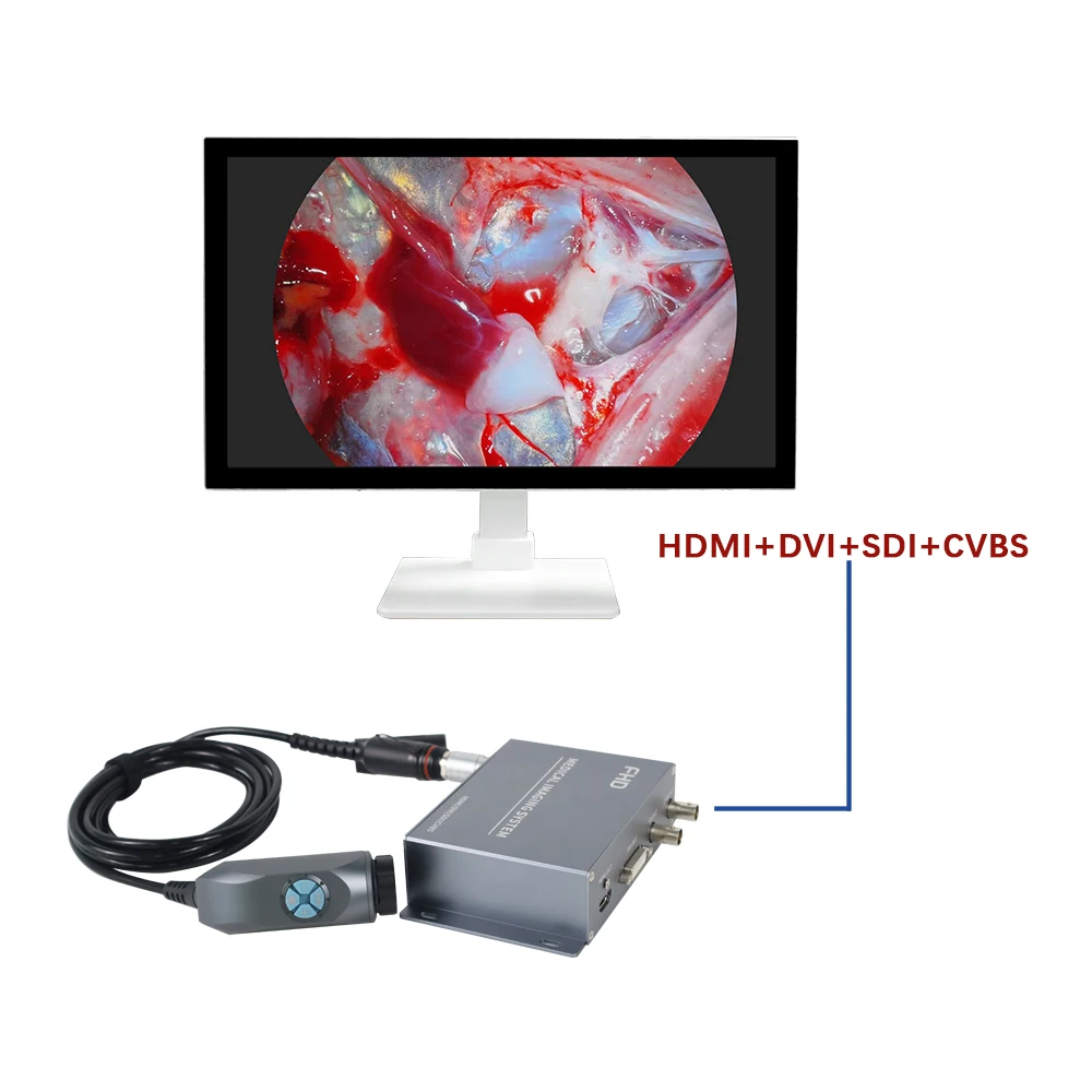 투유 휴대용 4포트 FHD 내시경 변환 박스 (이비인후과, 복강경, 반려동물 검사용)