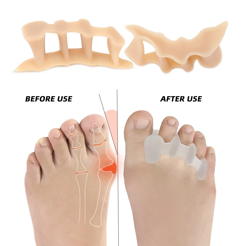 2pieces=1pair Gel Three-Holes Hammer Toes Orthotics Silicone Separators Hallux Valgus Thumb Bunions Corrector Foot Care Tools