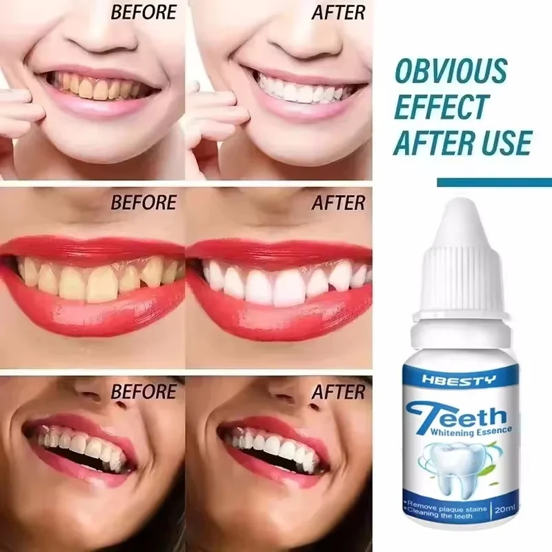 Powerful Tooth Whitening Essence Liquid Fast Remove Tooth Stains Yellow Teeth Tea Smoke Stains Cleaning Oral Cavity Fresh Breath