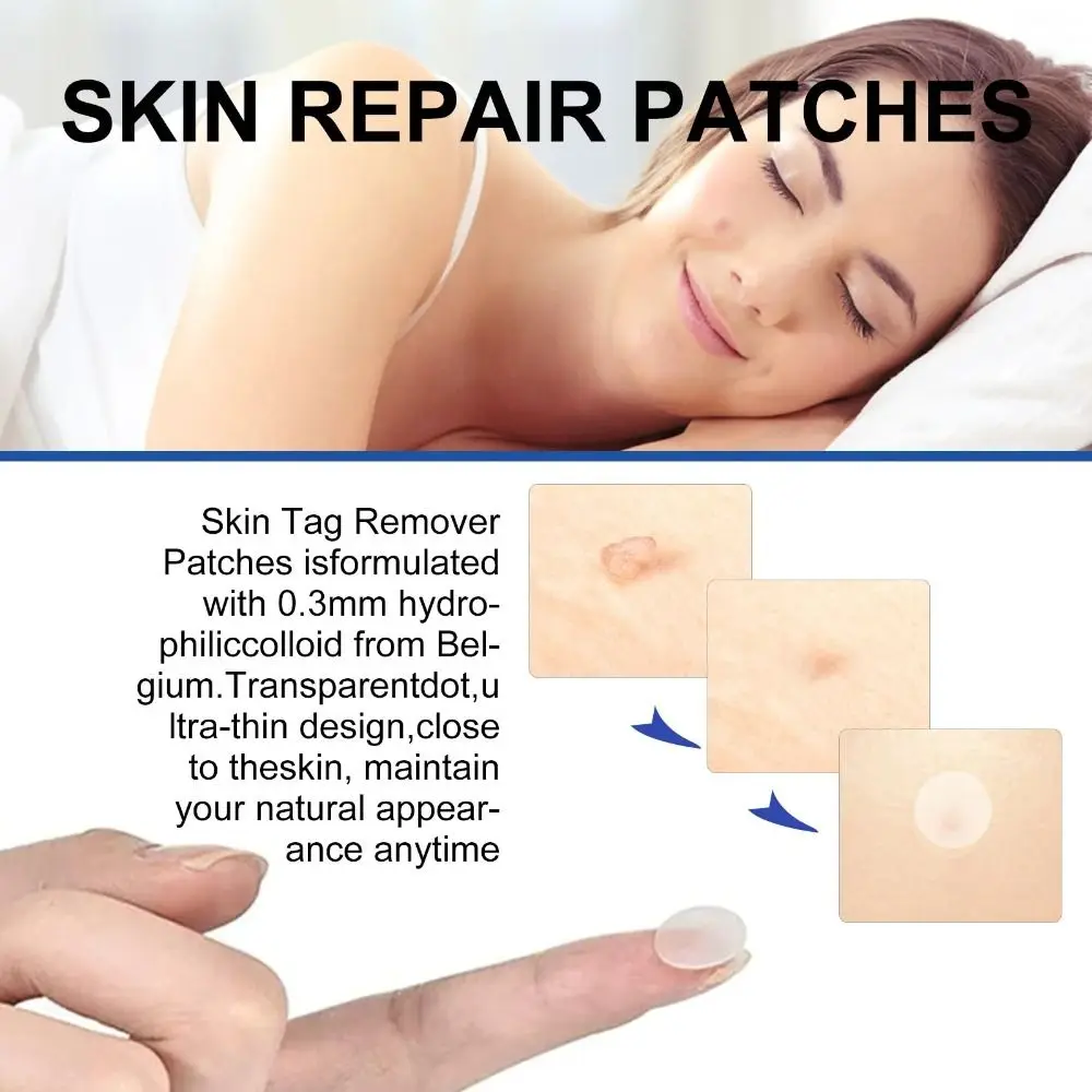 ใหม่ 2-IN-1 Skin Tag Removal เครื่องมือไม่เจ็บปวด ABS Mole สิวกําจัดหูดปากกาทําความสะอาด Swabs Facial Skin Care เครื่องมือผิว