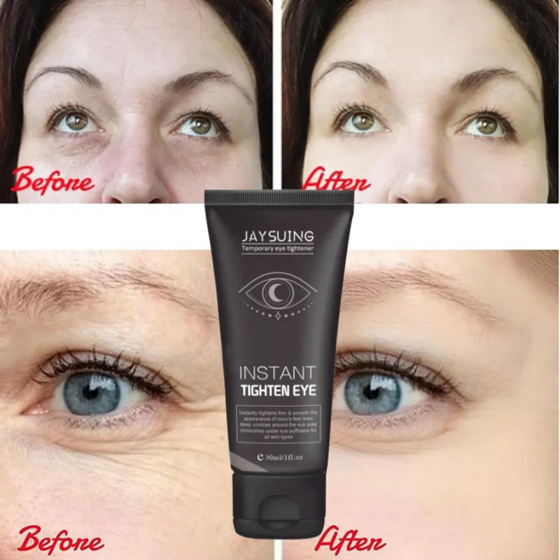 Anti Dark Circles Eye Bags Cream Instant Removal Wrinkles Fine Lines Under the Eyes Puffiness Lift Firming Eyes Skin Beauty Care