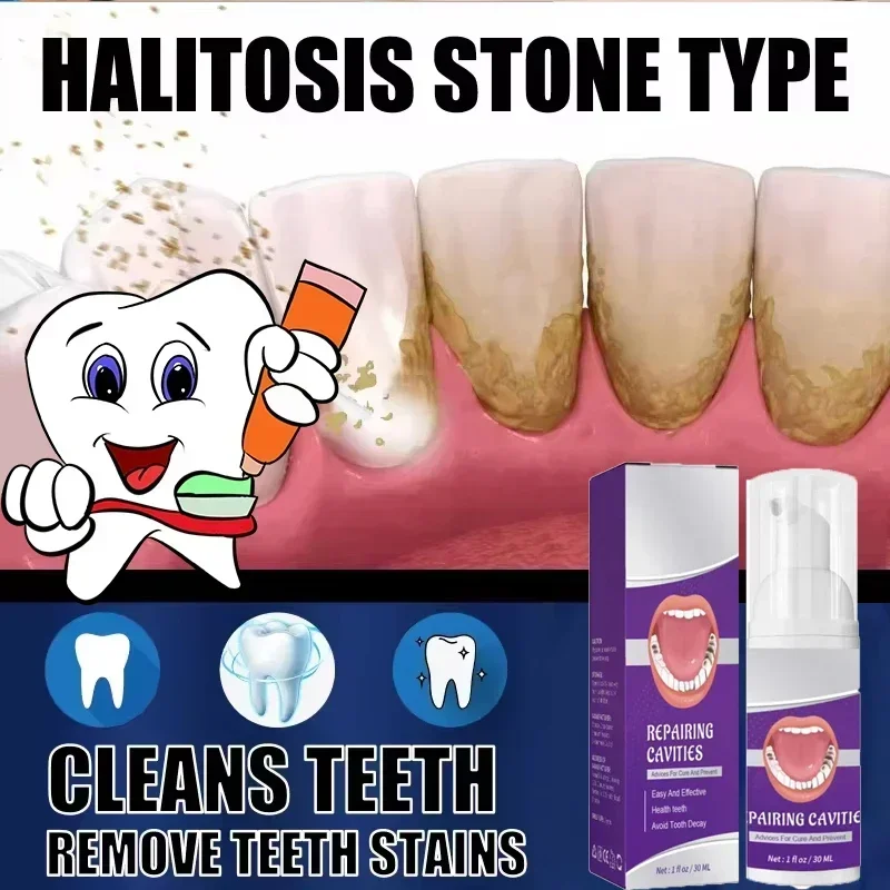 ²⁰²⁵ Toothpaste Whiten Clean Teeth Remove Stains Oral Care Management Fresh Breath