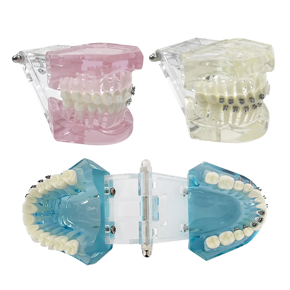 Dental Orthodontic Teeth Model with Ceramic Metal Self-Ligating Bracket Lingual Four Brackets Comparison Models Dentistry Teachi