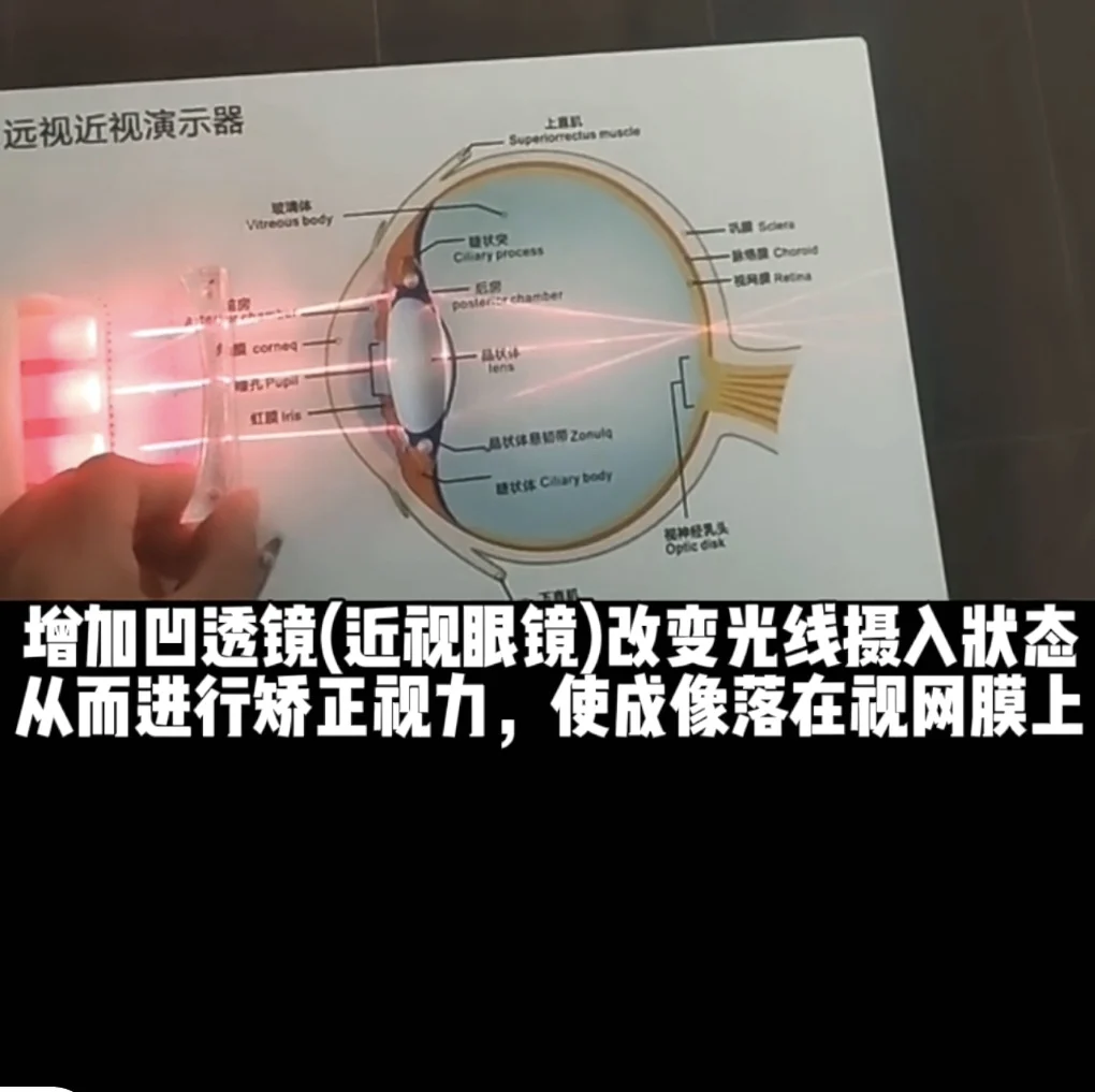 Farsightedness and myopia demonstrator, farsightedness props, eyeball analysis chart, the panel is made of metal 22 × 45CM.