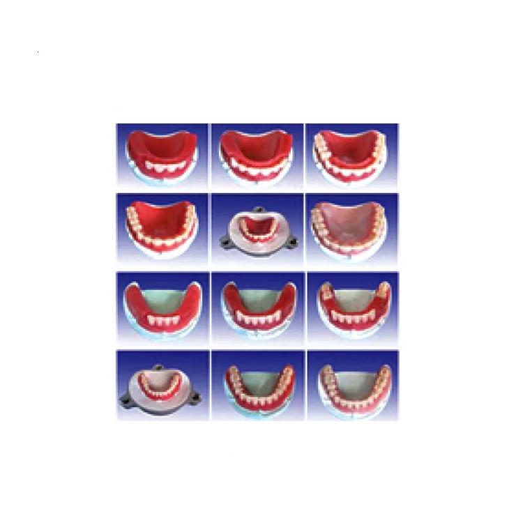 12PC/Set Dental Model Show the Producing Steps of the Holostomato