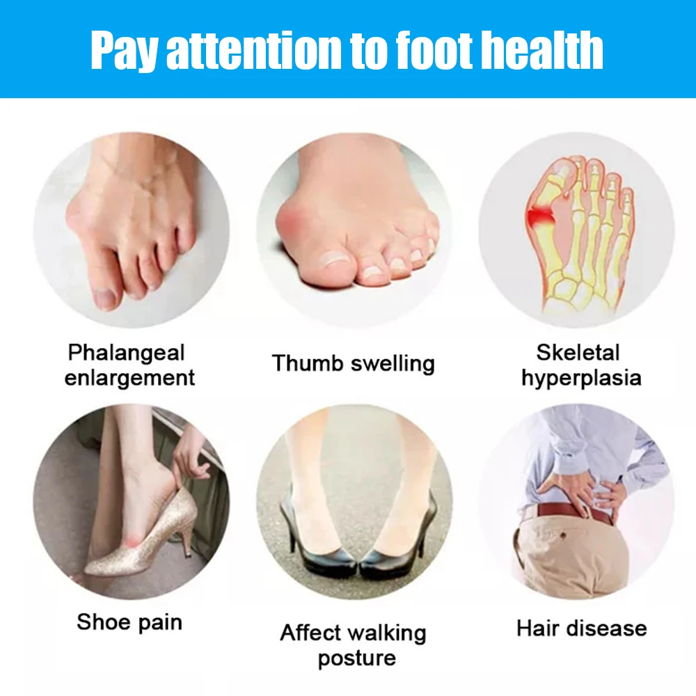 Correcteur de pouce en Gel de Silicone, 2 pièces, correcteur d'oignon, orteil, Hallux Valgus, séparateur de protection, lisseur de doigts, ajusteur, outils de soins des pieds