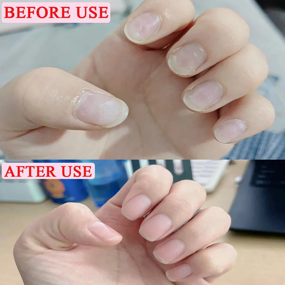 1/2pc Blume Duft Nagelhaut Öl Essenz Stift Für Drücker Nagel Abgestorbene Haut & Nagelhaut Entferner 3-in-1 Anti-barb Nagel Ernährung Öl Stift