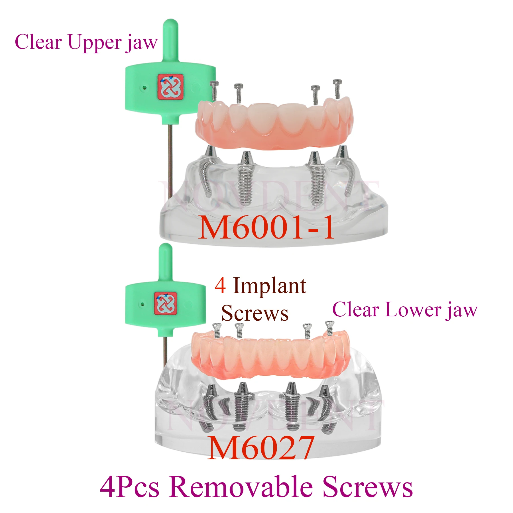 Dental Implant Teeth Model Upper/Lower Jaw 4 Implants Type All Have 4 Overdenture With 4 Removable Screws M6001-1 M6027