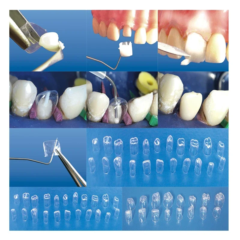 64 pcs/box Dental Transparent Crown Children Anterior Posterior Complete Temporary Preformed Pre-crown Matrices Matrix 1.912