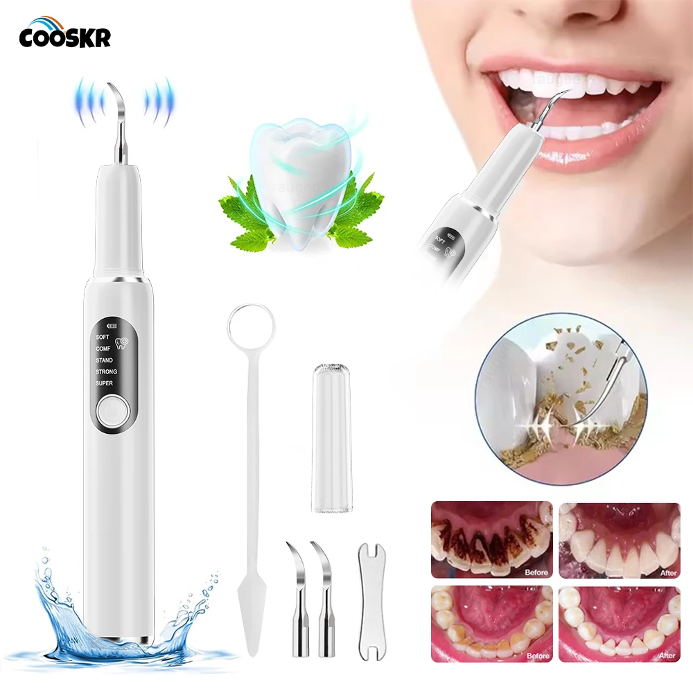 

Ультразвуковой очиститель зубов, средство для удаления зубного камня, 38 кГц, высокочастотная вибрационная машина для чистки зубного налета со светодиодной УФ-подсветкой