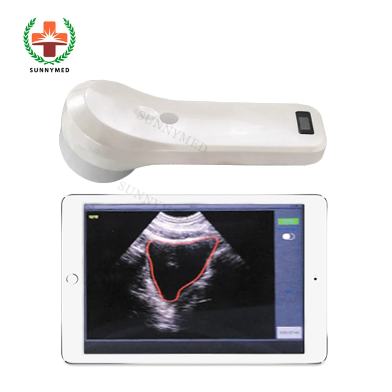 SYBS03 Hospital urology ultrasound bladder scan machine 4D bladder scanner