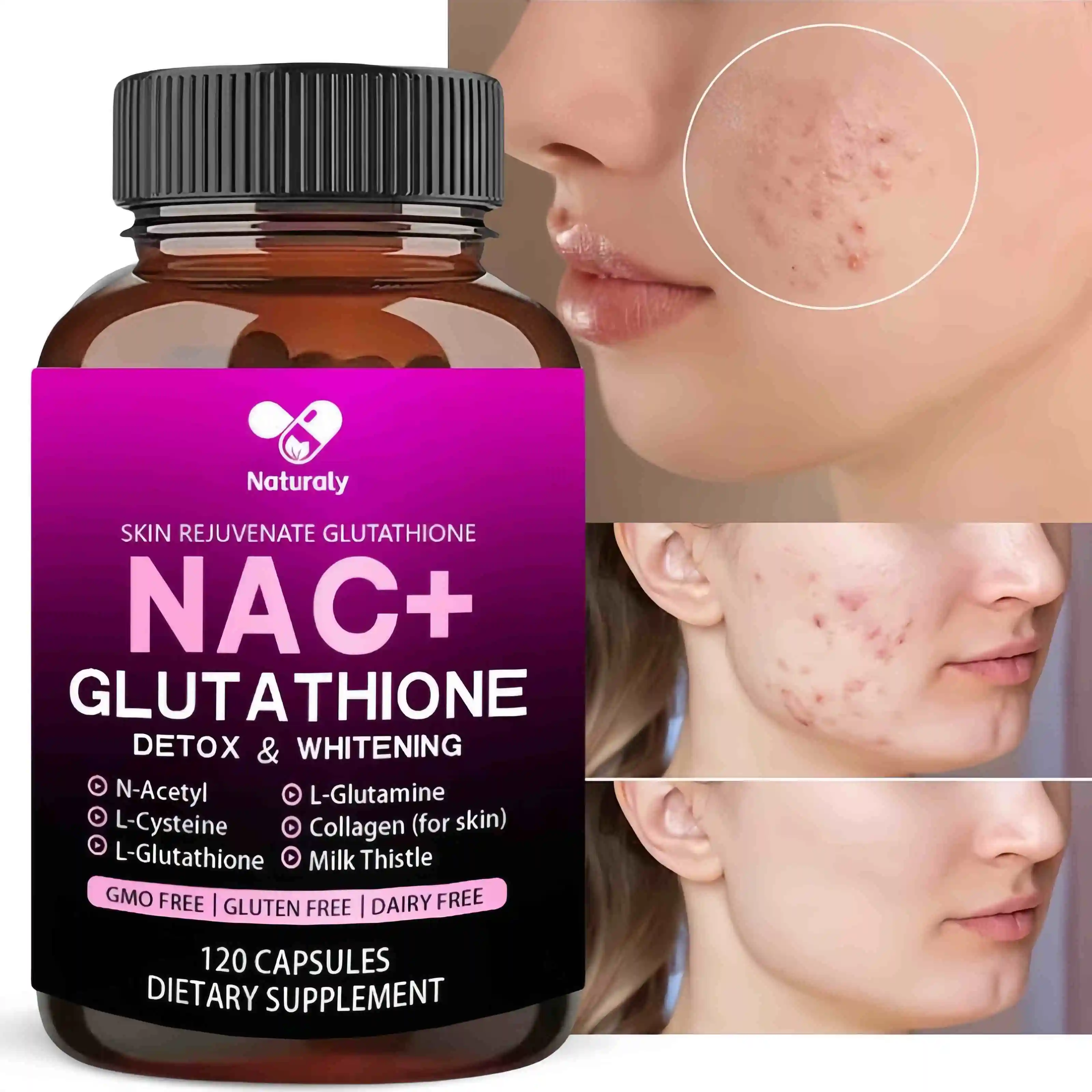 NAC+Glutathione Capsules β Detoxification, Whitening, Immunity, Cell Growth and Repair, Antioxidant Supplement
