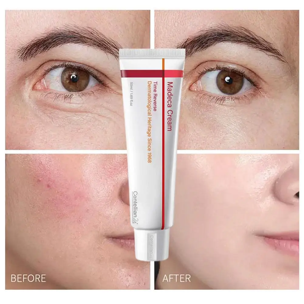 1/4pcs PDRN Centellian 24 Moisturizing Hydrating Face Cream 50ml Strengthen Skin Barrier Under Makeup Glow Smoothness SKIN CARE