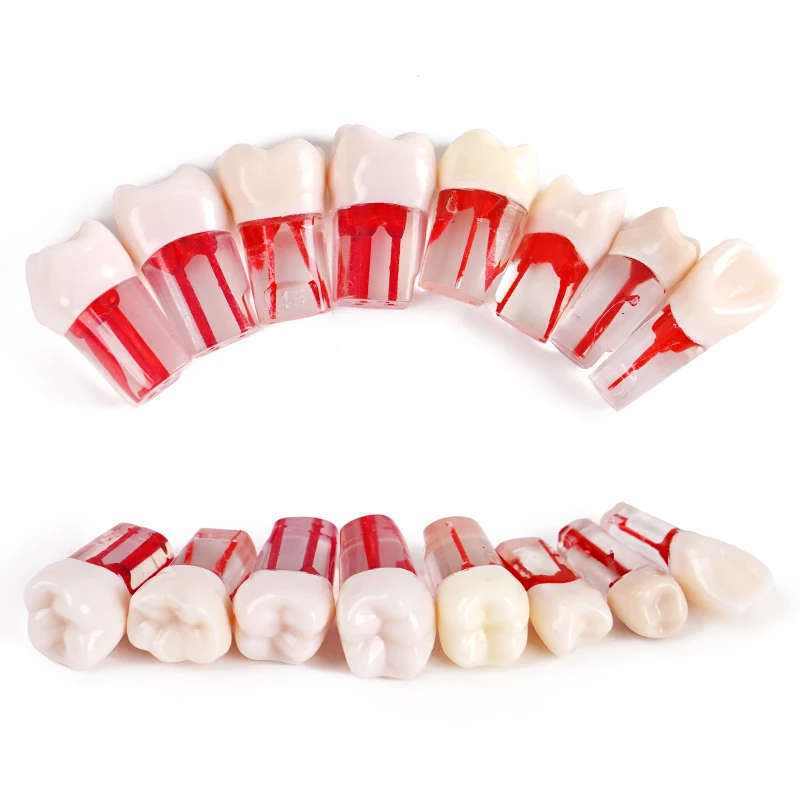 Modelo de dente do canal radicular dentário, bloco de treinamento endodôntico, prática RCT, ensino de odontologia, 5pcs