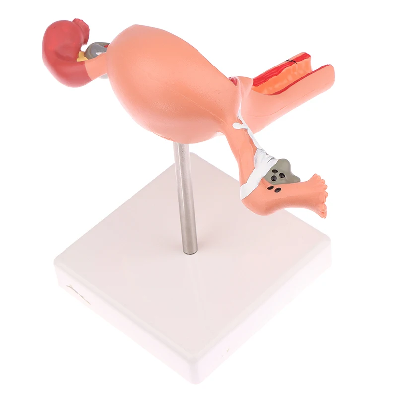 Human Pathological Uterus Ovary Model Cross Section Structure Model Uterus Anatomical Model Anatomy Female Organ Study Tool