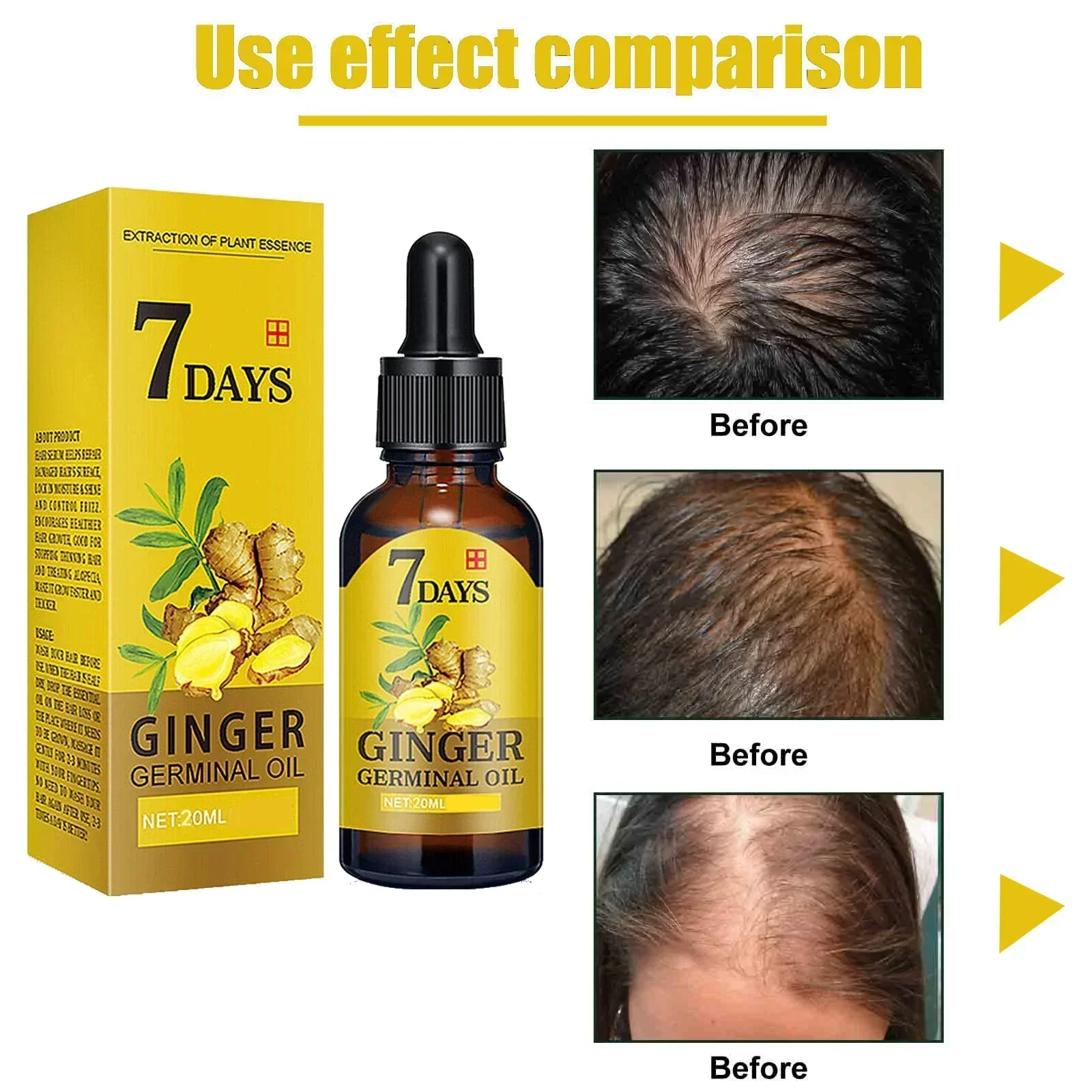 Fast Ginger Hair Growth Serum Anti Hair loss Baldness Regrowth Hair Care Oil Repair Damaged Scalp Treatment For Women Men