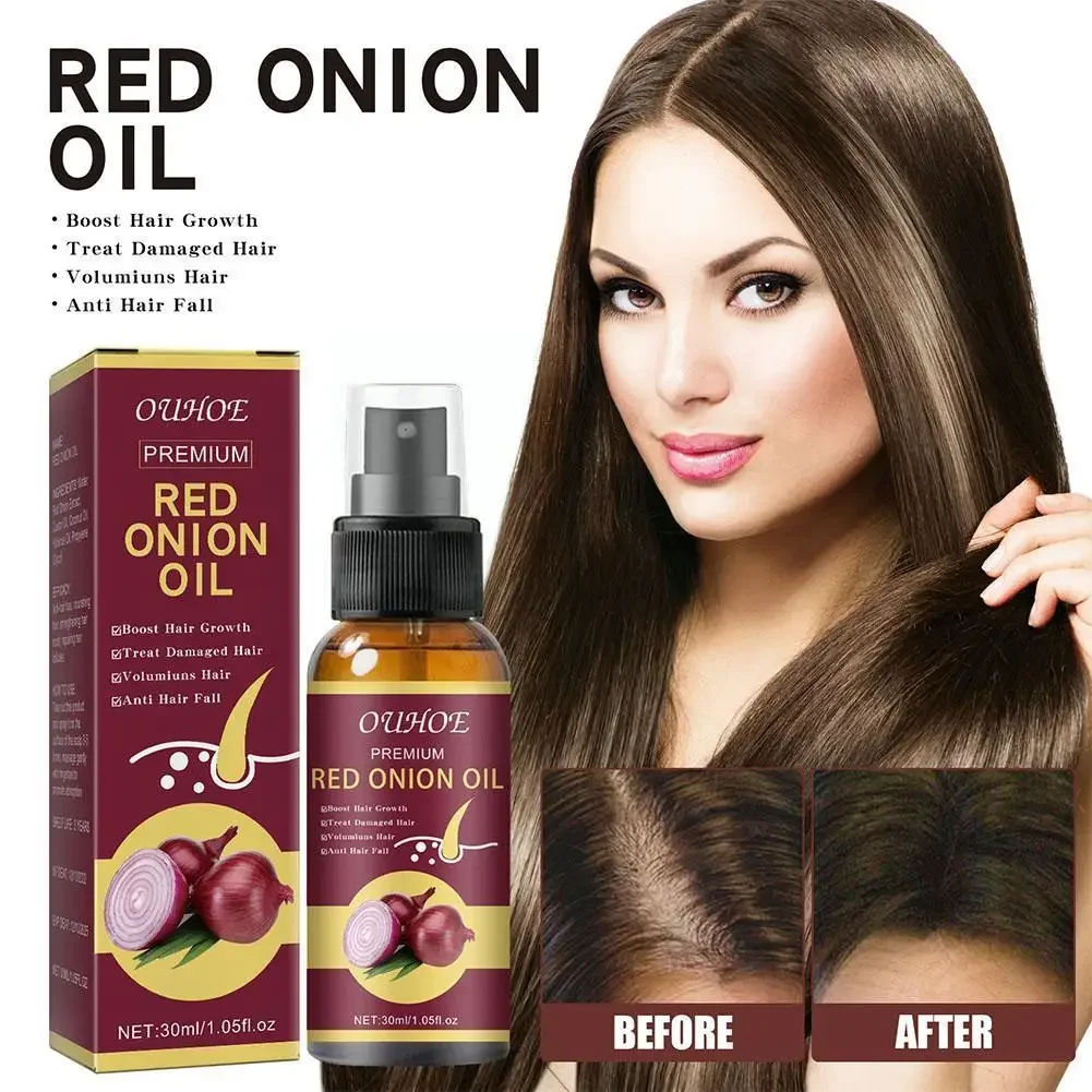 

30ml Onion Black Seed Hair Oil Spray, Natural Hair And Hair Biotin Care Fast Loss, Prevent Q5K1