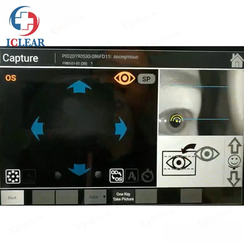 China 3D Hr Digital Automatic Non-Mydriatic Fundus Camera with FFA/FAF