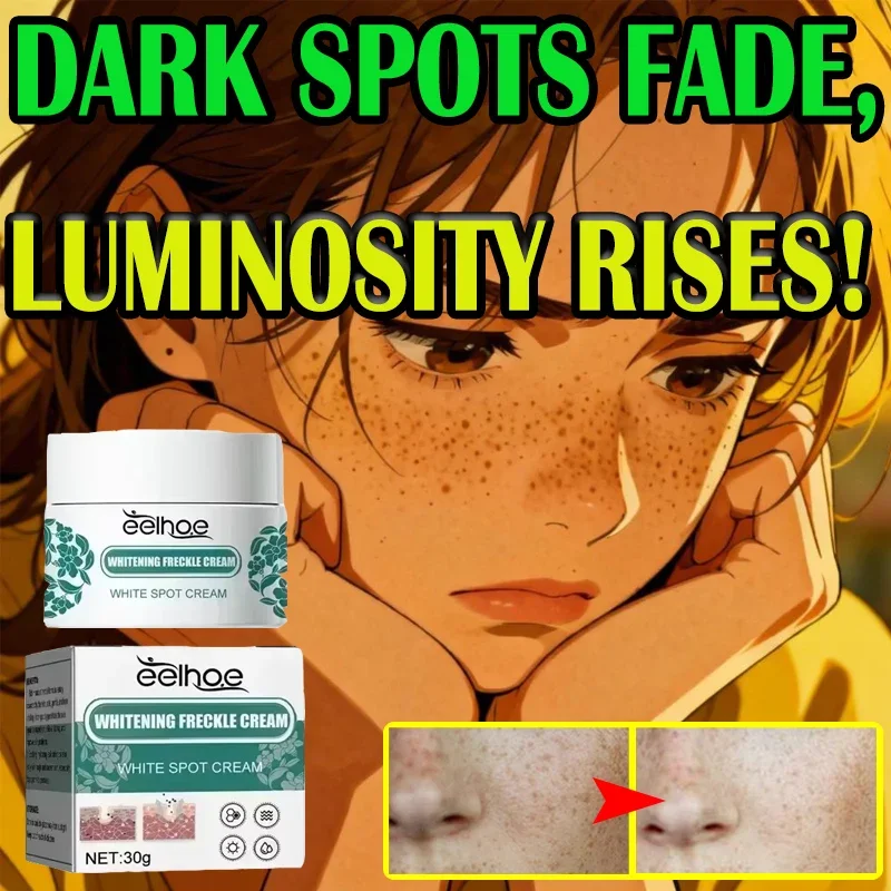 

EELHOE никотинамидный крем от веснушек, средство для удаления мелазмы, крем для удаления пигментации, отбеливающий крем от веснушек, осветляющий ремонт