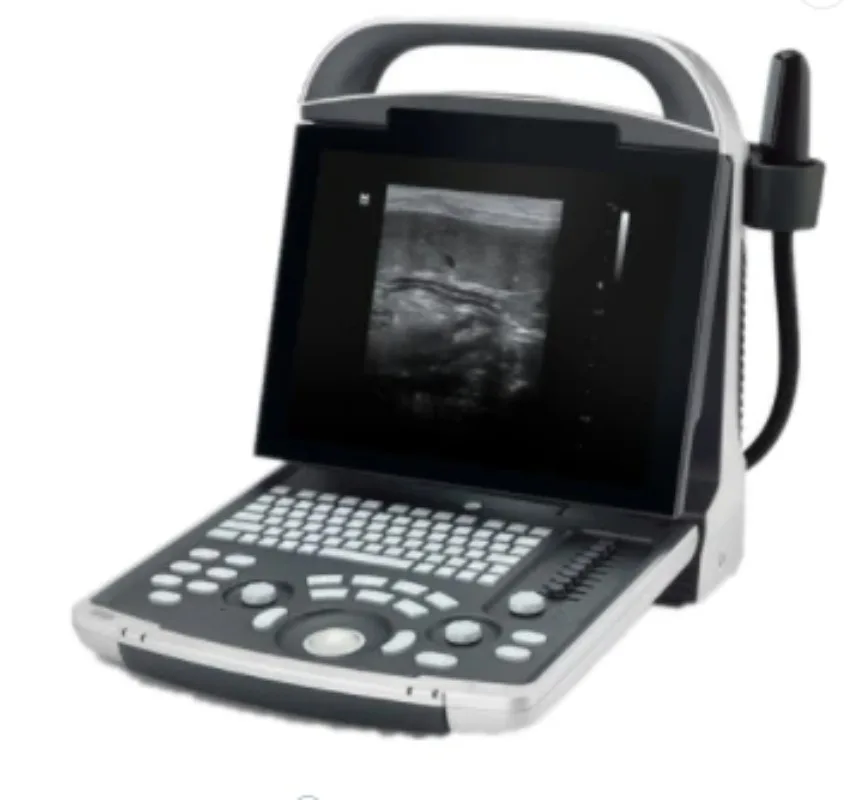 portable ultrasound machine LED screen digital scanner for animal and human