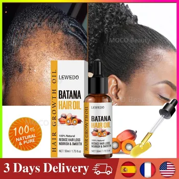Batana Oil Hair Growth ผลิตภัณฑ์ Fast Growth Batana Essence Oil Traction ผมร่วง Anti Hair Loss หัวล้าน Treatment สําหรับผู้ชายผู้หญิง