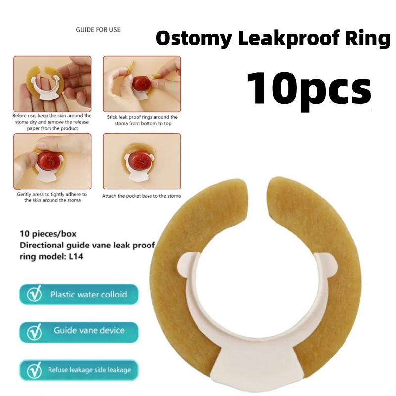 10Pcs Ostomy Paste Ring Baseplates Stoma Care Leak-Proof Ring For Ostomy Bag Stretch Shaping To Prevent Leakage Protect