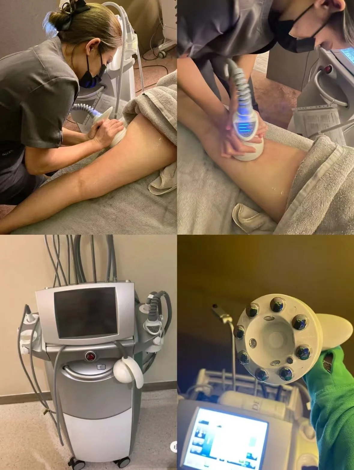 Venus Legacy Body Machine Cellulite Treament Portable Radio Frequency Original Cavitation Vacuum Legacy Skin Lifting SPA Device