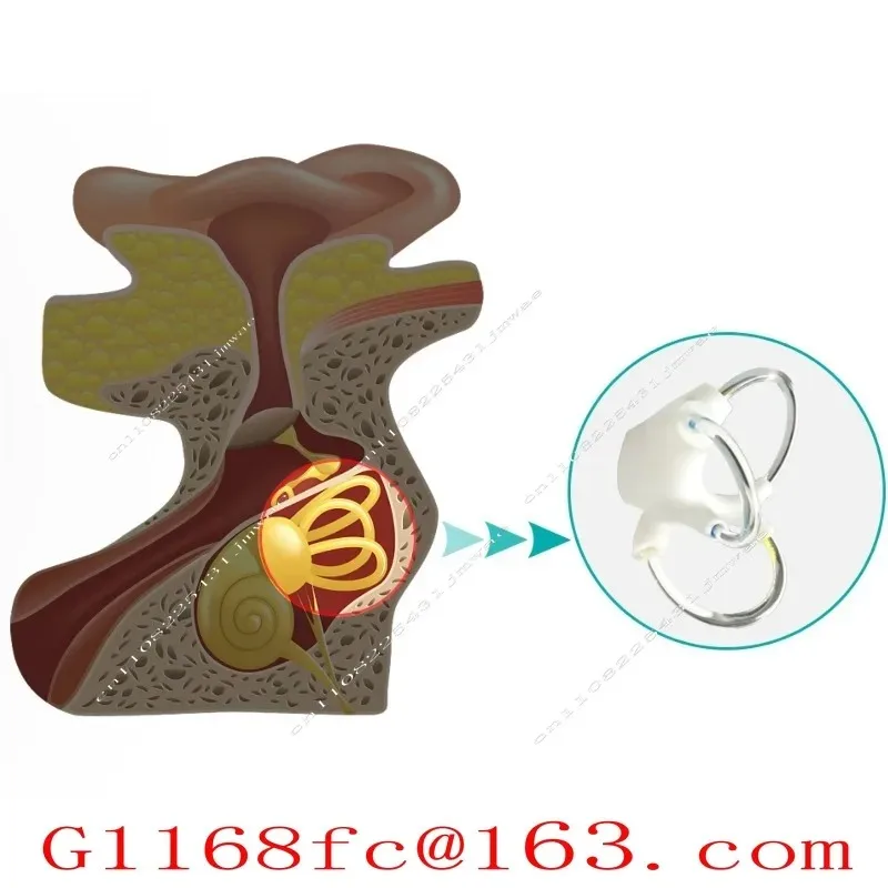 Semicircular Canal Otolith Anatomy Model Skeletal Cochlear Inner Ear Structure Cerebroneural Vestibular Rehabilitation.