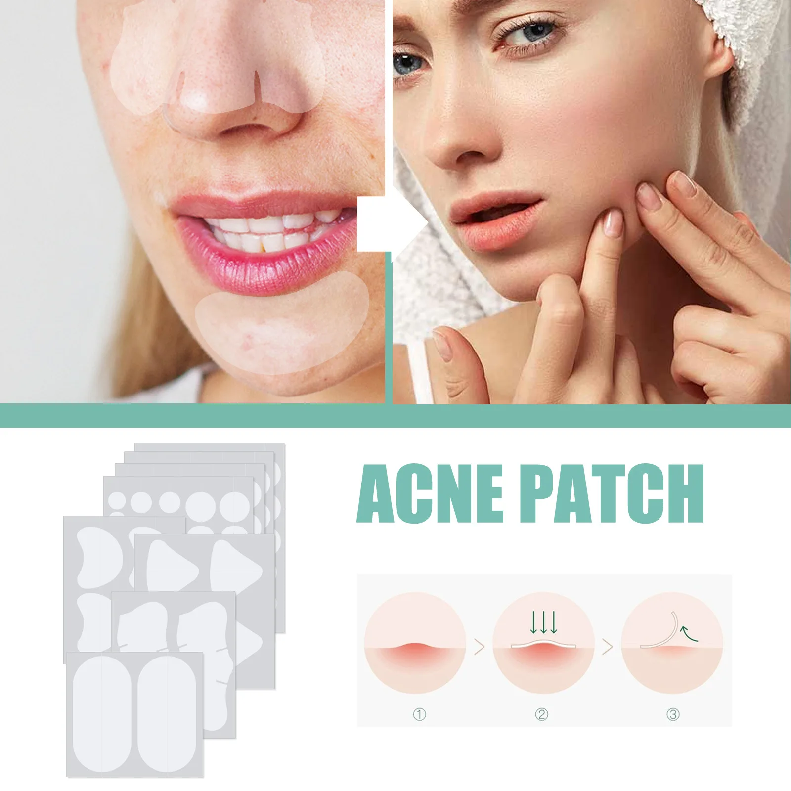 132/264Pcs Acne Pimple Patches Skin Blemish Treatment  Patches Professional Face Cleaning Care Invisible Hydrocolloid Sticker