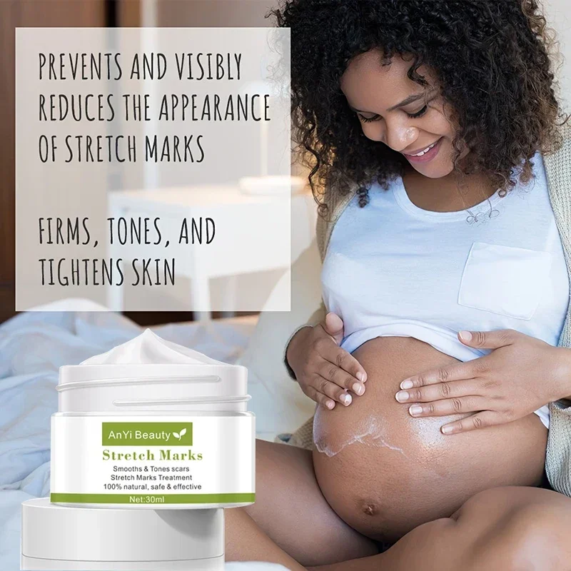 

Pregnancy Stretch Mark Repair Cream Stretch Scar Marks Remover Maternity Obesity Treatment Body Postpartum Smooth Skin Care