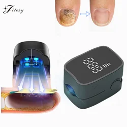 Nail Fungus Treatment LED Laser Device for Cleaning Onychomycosis Digital Display 905nm Infrared Light 470nm Blue LightNailSalon