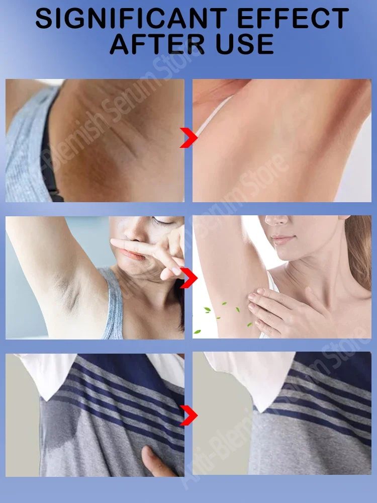 Armpit Odor Remover Woman For Strong Sweat Body Odor Anti Sweating