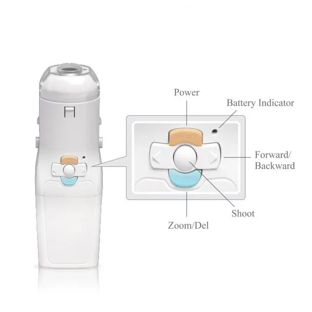 

Portable Mini Handheld Digital Video for gynecology home use video colposcopio digital portatil