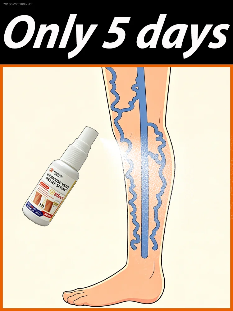 

This spray ᴇʟɪᴍɪɴᴀᴛᴇs ᴠᴀʀɪᴄᴏsᴇ ᴠᴇɪɴs, sᴏ ʏᴏᴜ don't have to ғᴇᴇʟ ᴜɴᴄᴏᴍғᴏʀᴛᴀʙʟᴇ ᴏʀ ᴀsʜᴀᴍᴇᴅ ʙᴇᴄᴀᴜsᴇ ᴏғ ᴛʜᴇᴍ.
