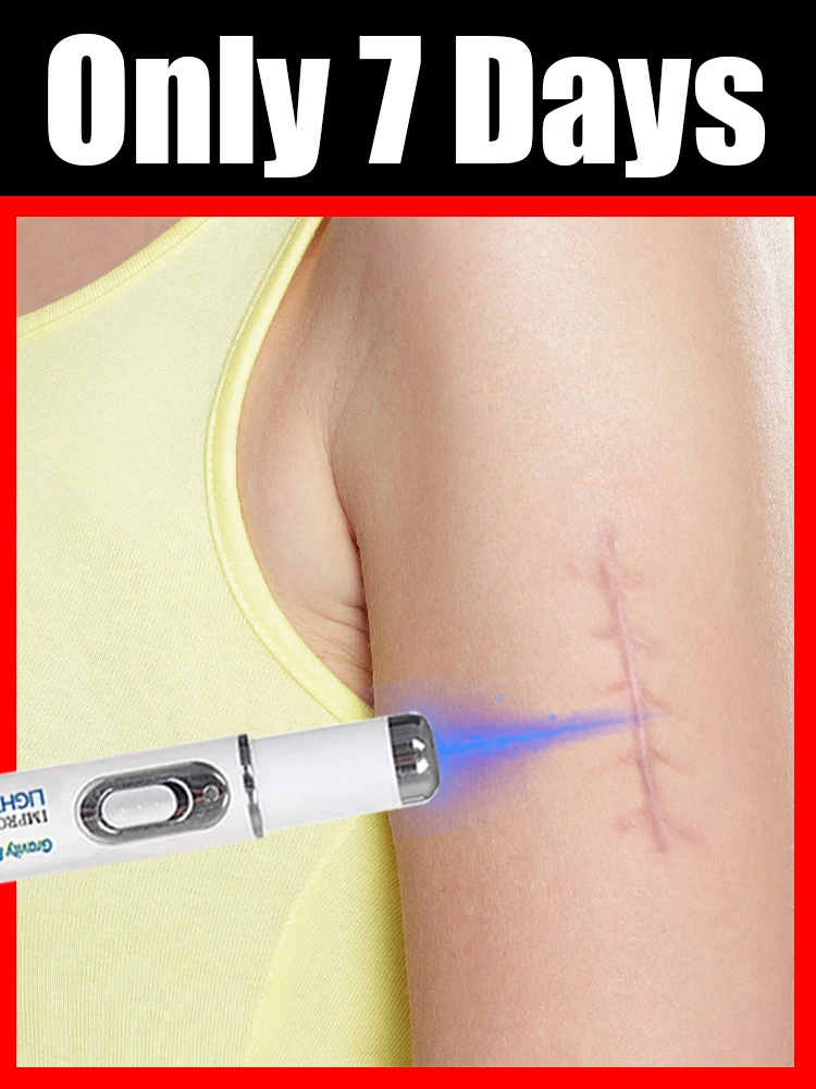 

Инструмент Scars Blue Light, больше скидок на установках