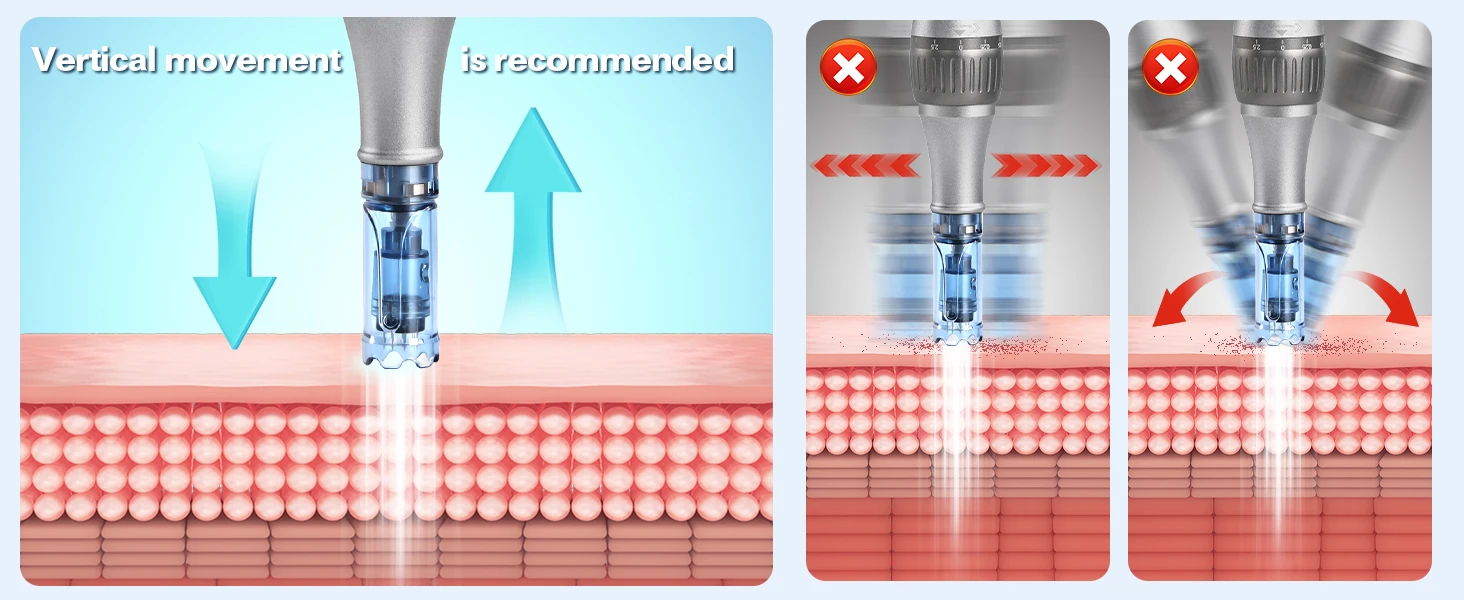 Dermapen M8S-Patronen, 12/36PIN Microneedling-Patronen für A8S M8S A9 A11, Einweg-Ersatz-Microneedling-Nadeln – Detail 6