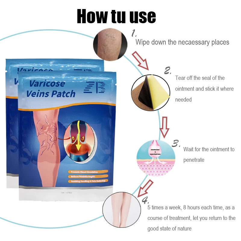 Traditional Chinese Medicine Varicose Veins Patches Relieve Numbness Swollen Pain Dressing Promoting blood Circulation Patches