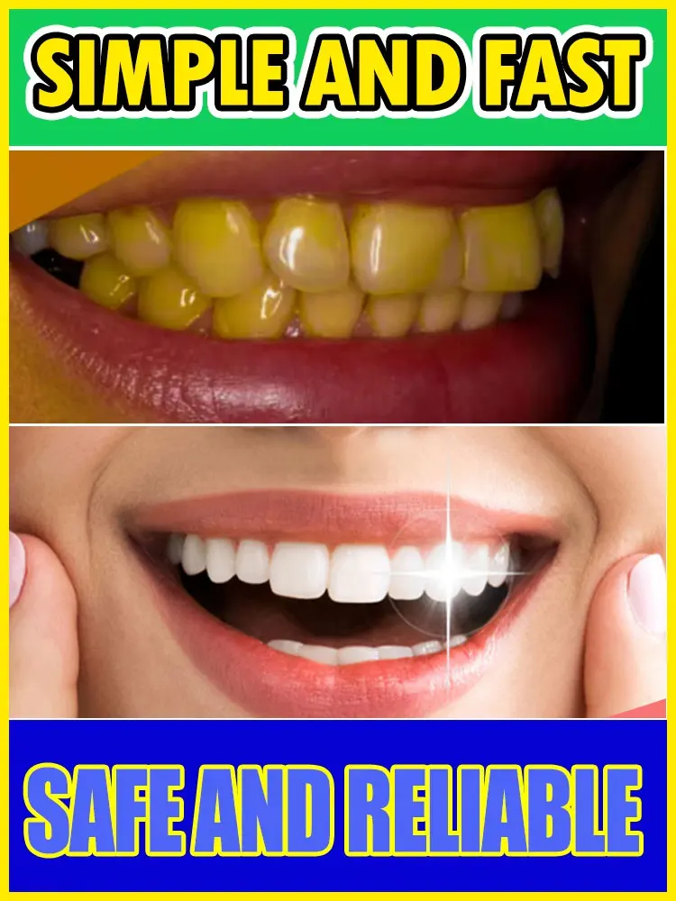

Hot selling Tooth repair tooth decay