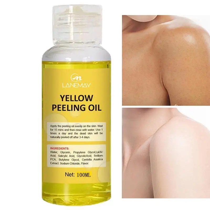 Yellow Peeling Oil Bleaching Dark Skin Lighten Elbows Knees Hands Melanin Even Skin Tone Exfoliating Whitening Body Serum