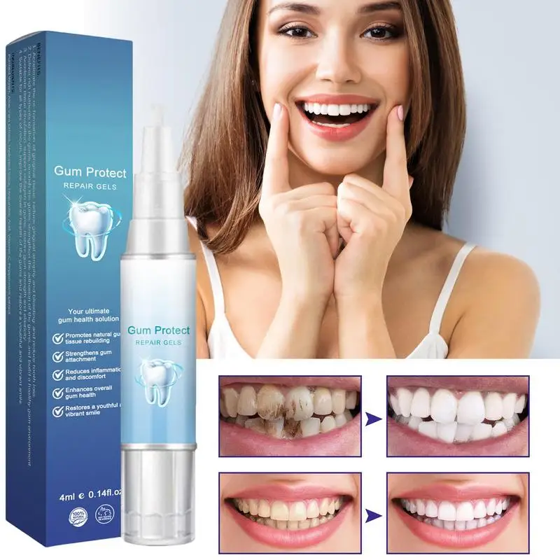 Painless Teeth Whiten Gel Instant Teeth Whitener And Stain Remover Safe Painless Natural Formula Removes Soda Tea Coffee Wine