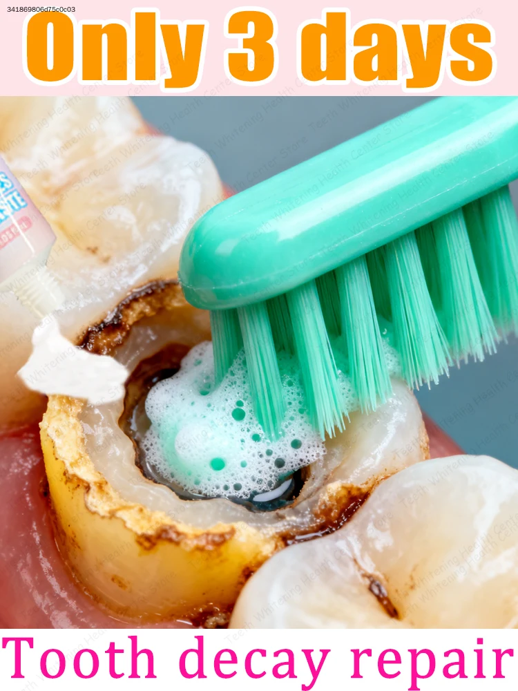 Effective oral cleaning and ᴛᴏᴏᴛʜ ʀᴇᴘᴀɪʀ ɪɴ 3 ᴅᴀʏs