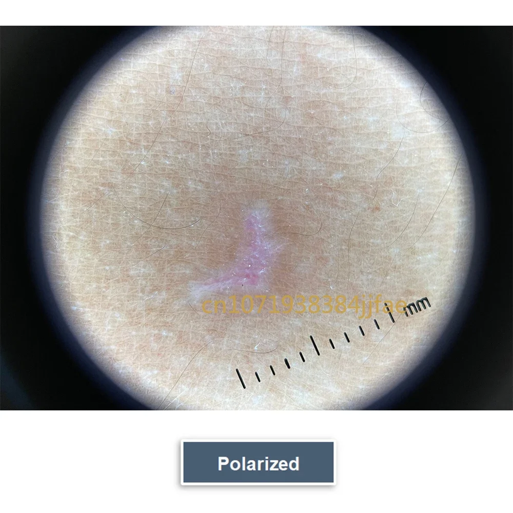 ميكروسكوب محمول لبشرة الوجه ، مستقطب ، 10x