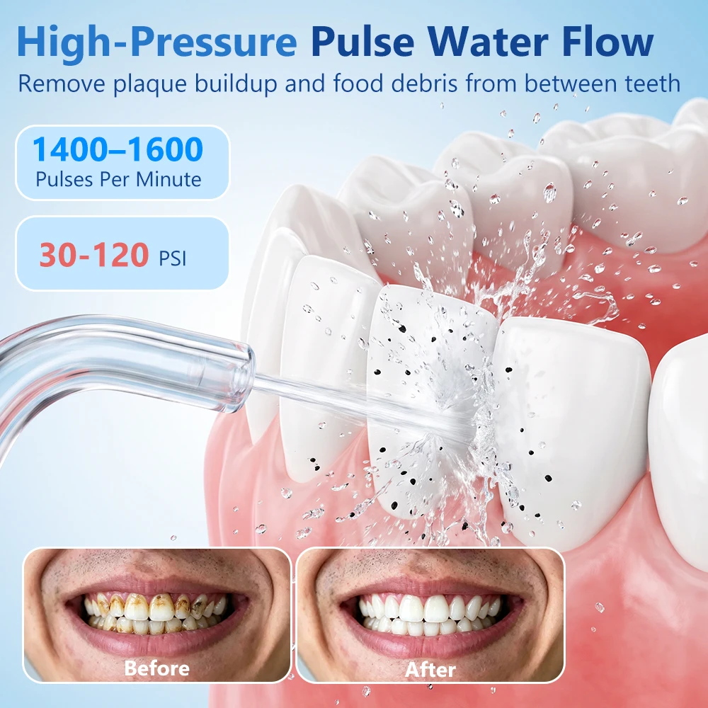 Household Dental Oral Irrigato - огляд і ціна Water Flosser Cordless